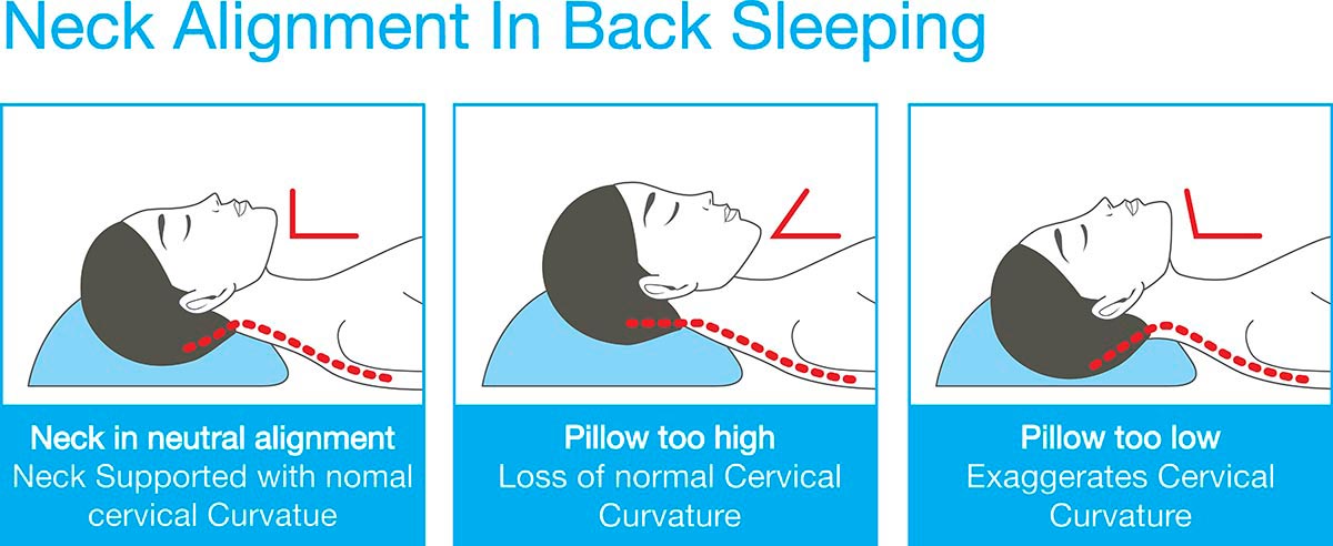 Neck alignment in back sleeping