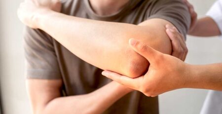 elbow pain treatment Toronto osteopath